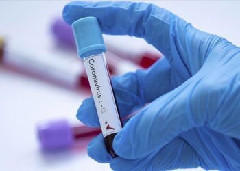 Coronavirus. Taormina. Sospesi i ricoveri in Ortopedia all’ospedale “S. Vincenzo” dopo il caso della donna di Furci risultata positiva