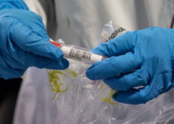 Coronavirus. Pasqua più serena a Taormina. Negativi anche gli ultimi 4 tamponi effettuati al personale dell’ospedale