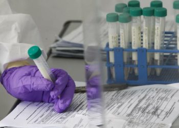 Coronavirus. Giardini. Il sindaco: “Negativo l’esito dei 39 tamponi effettuati ai cittadini in isolamento domiciliare”