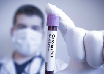 “Ho avuto il coronavirus a dicembre ma l’ho scoperto alcuni giorni fa con il test sierologico”